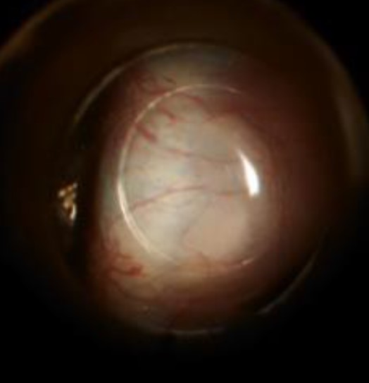 Automated Venomanometry